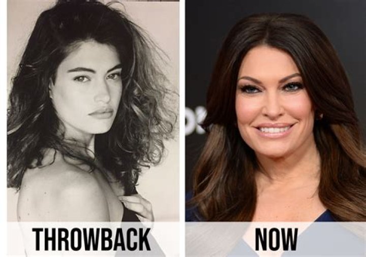 Transformations In The Spotlight: Kimberly Guilfoyle Before And After Surgery
