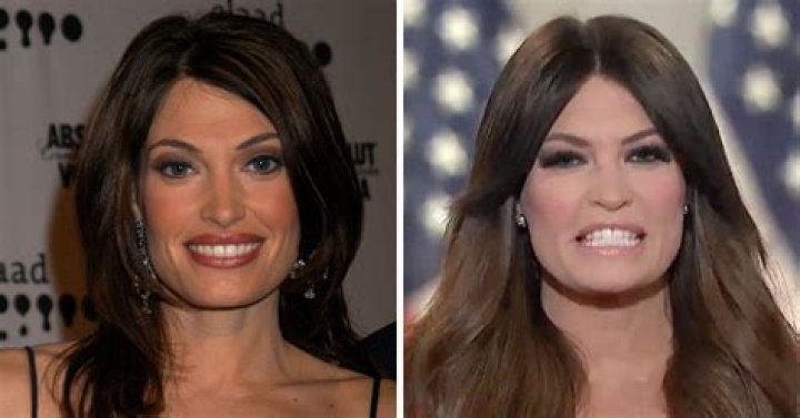 Transformations: Kimberly Ann Guilfoyle Before And After