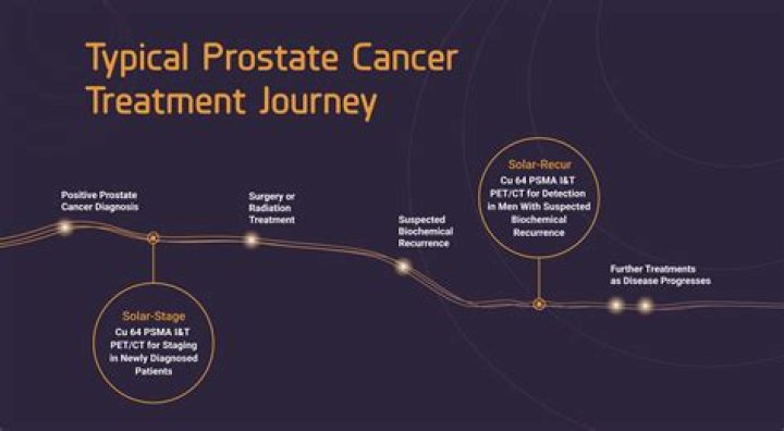 Understanding Cezar Stan's Cancer Journey And Its Impact
