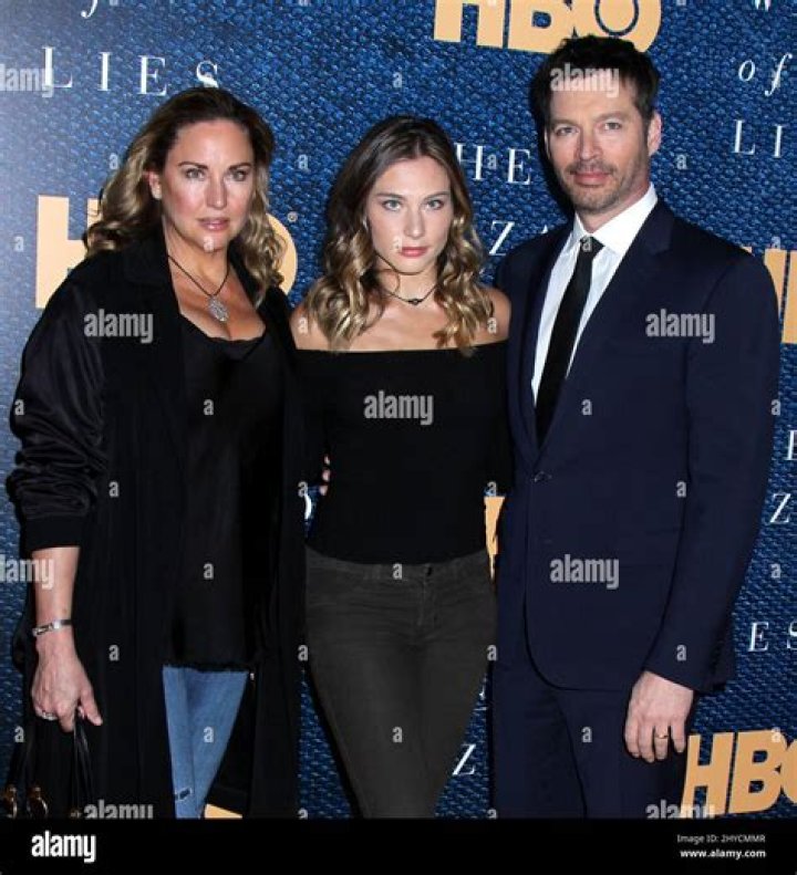 Unveiling The Truth: Does Harry Connick Jr Have A Scar On His Face?